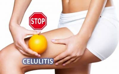 Cómo reducir la celulitis